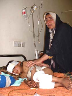 Child victim of war on Iraq